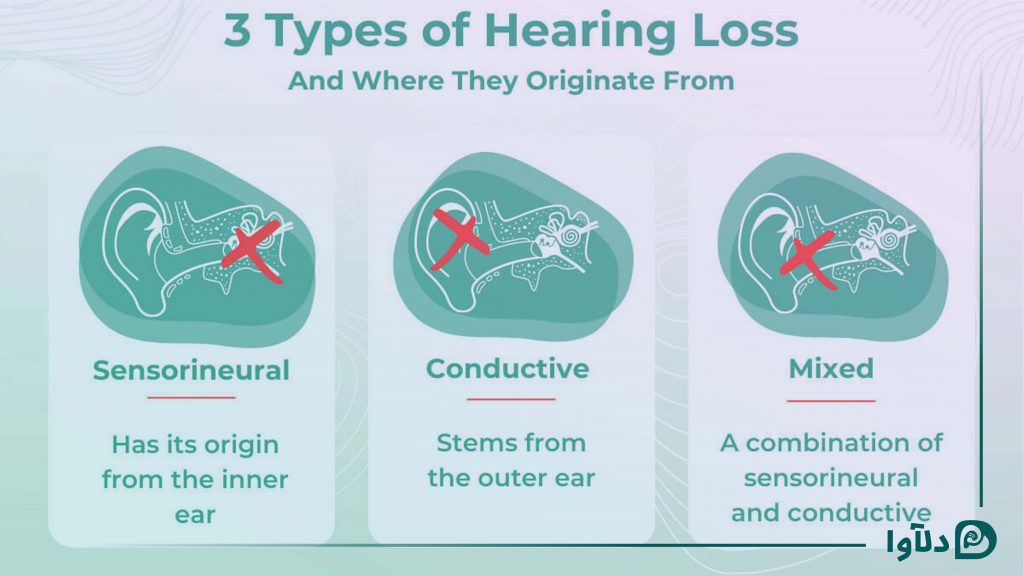 انواع کم شنوایی - تست شنوایی دلاوا سمعک
