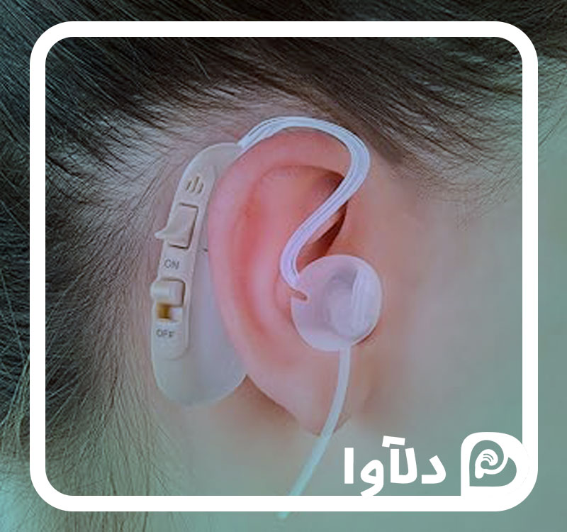 قیمت سمعک دیجیتال در سال 1404 | لیست قیمت انواع سمعک دیجیتال